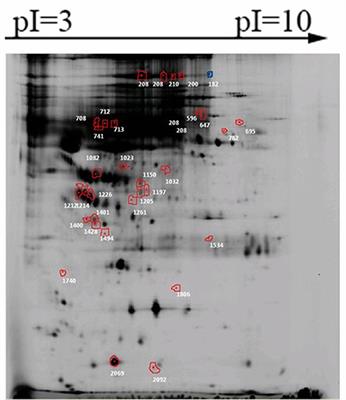 Serum Clusterin and Complement Factor H May Be Biomarkers Differentiate Primary Sjögren's Syndrome With and Without Neuromyelitis Optica Spectrum Disorder